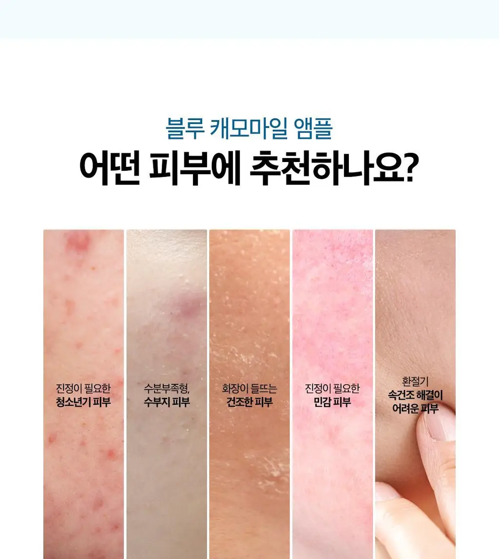 [쫀득물착앰플] 스킨푸드 블루 캐모마일 히알루로닉 앰플 50ml 상세페이지 22